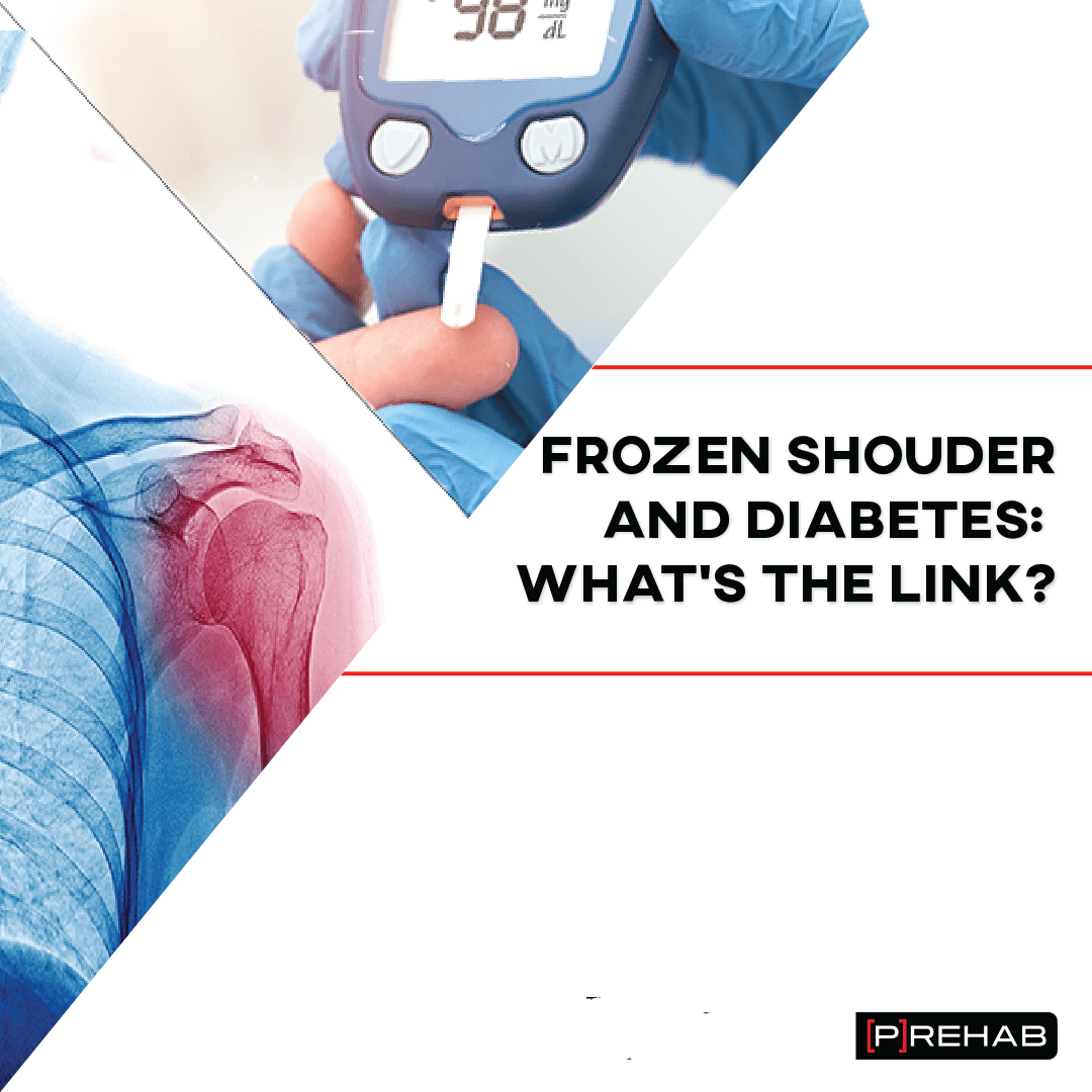Capsulitis Shoulder Diabetes